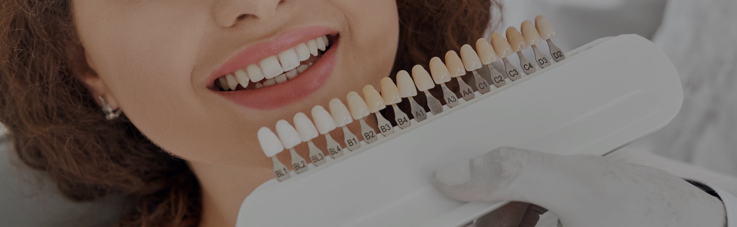 Smile Dental Clinic Dental Veneer Banner
