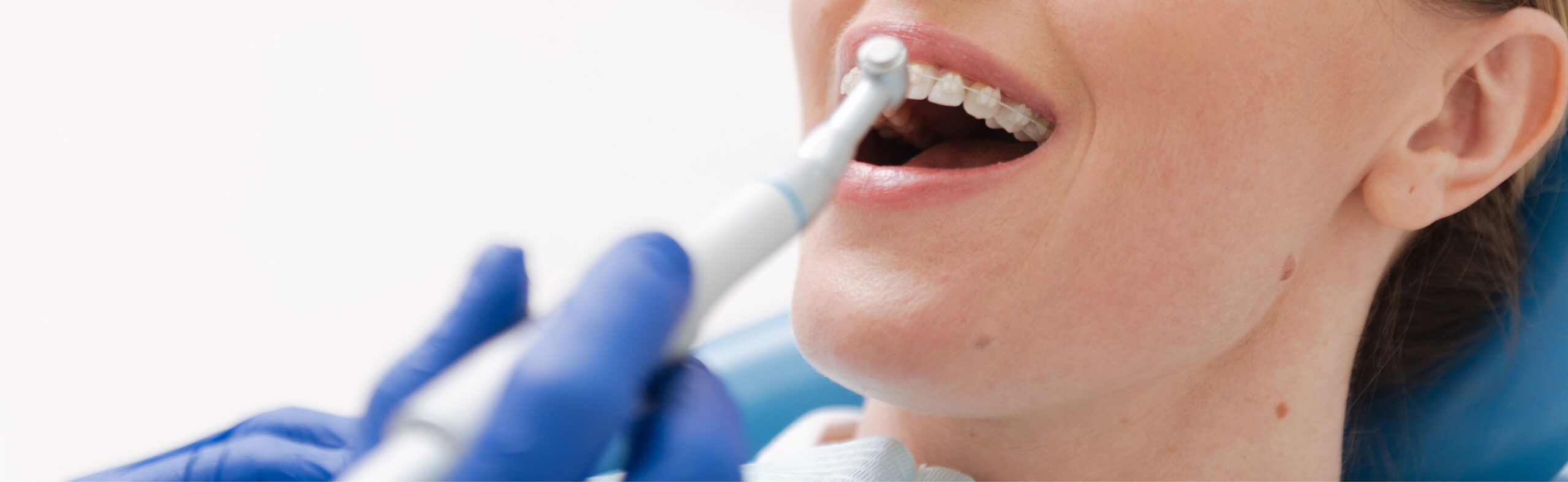Smile Clinique Traitement Parondontal Bandeau